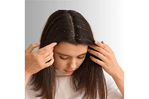 Dandruff Treatment